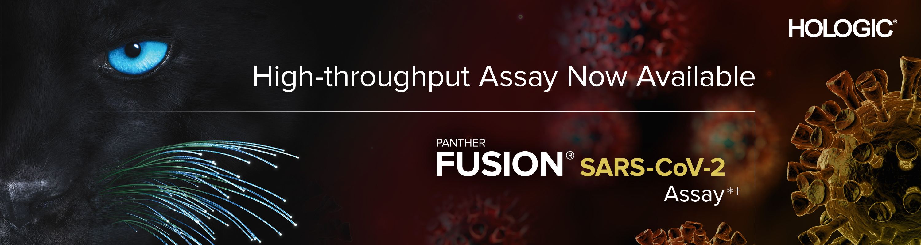 New SARS-CoV-2 assay available for Hologic Panther Fusion 